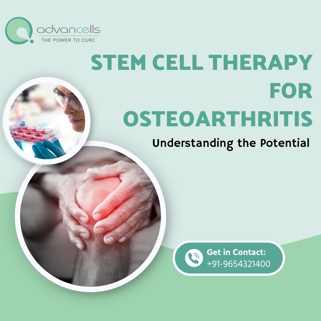 Stem Cell Therapy for Osteoarthritis: Understanding the Potential