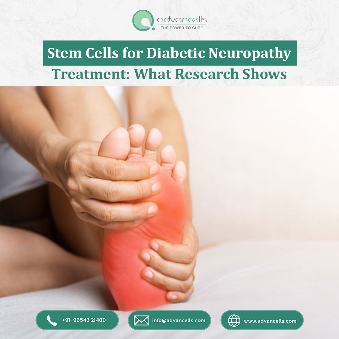 Stem Cells for Diabetic Neuropathy Treatment: What Research Shows