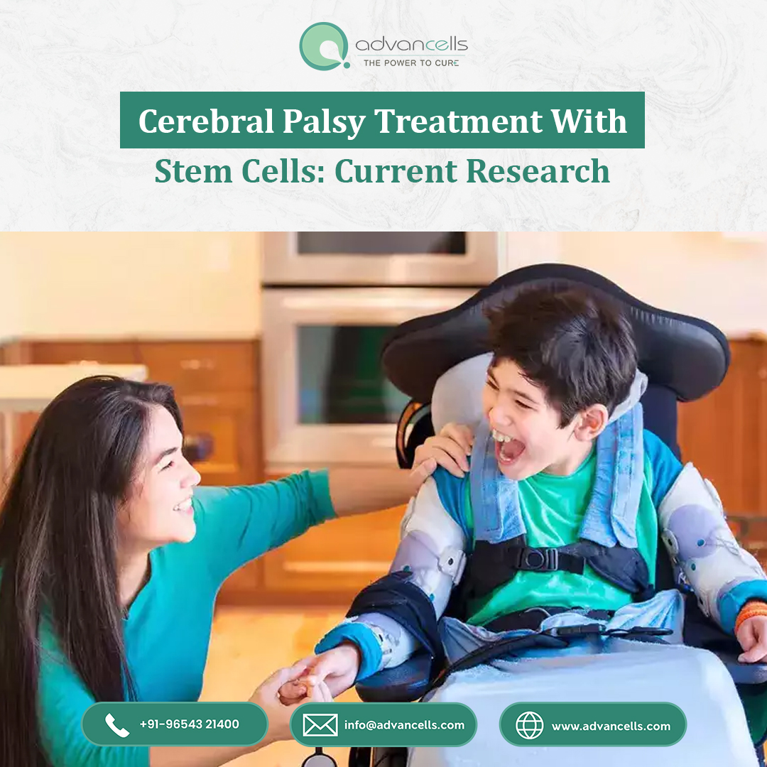 Cerebral Palsy Treatment with Stem Cells: Current Research