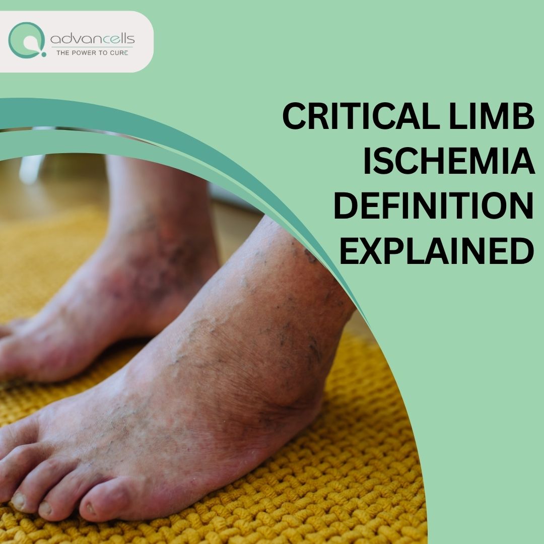Critical Limb Ischemia Definition Explained