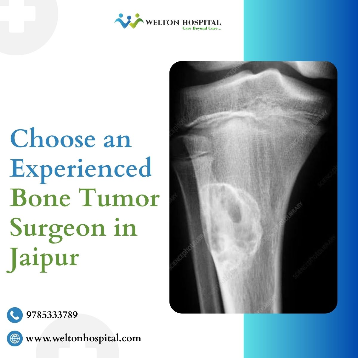 Choose an Experienced Bone Tumor Surgeon in Jaipur