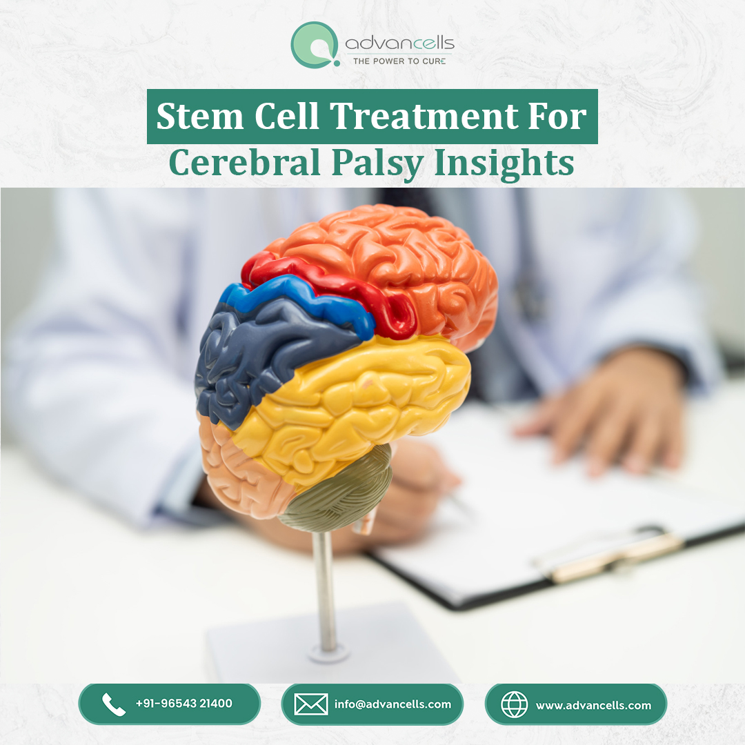 Stem Cell Treatment for Cerebral Palsy Insights