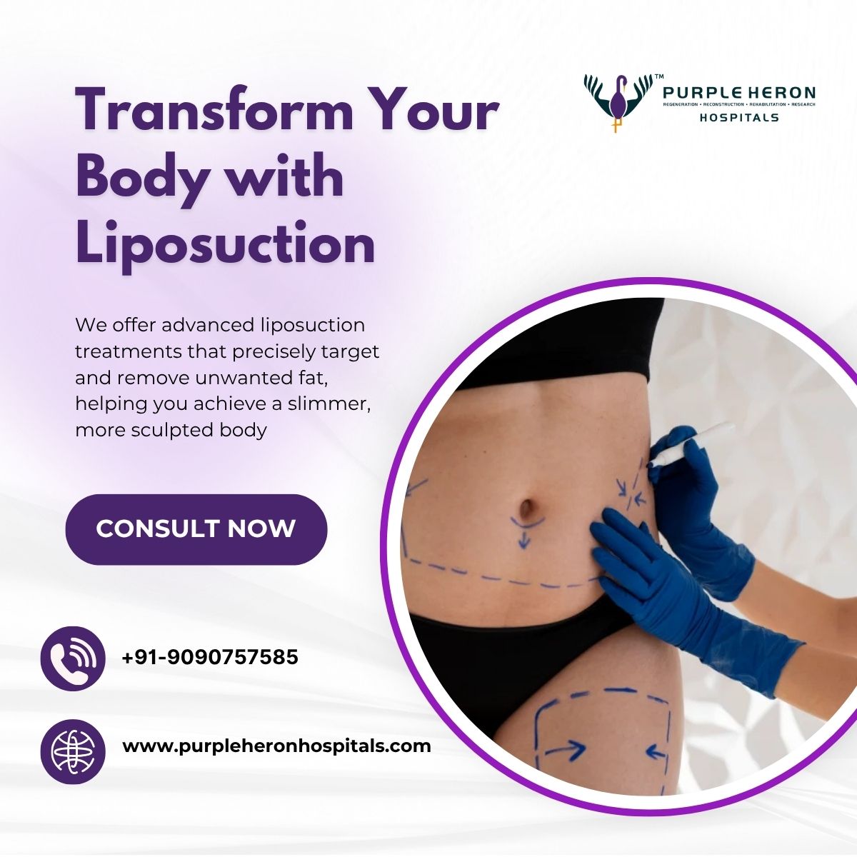 Transform Your Body with Liposuction at Purple Heron Hospitals