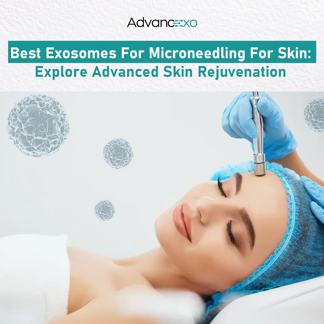 Best Exosomes for Microneedling for Skin: Explore Advanced Skin Rejuvenation