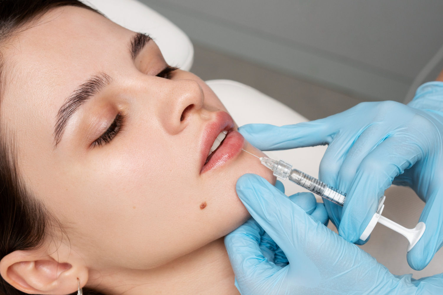 Lip Filler Cost in Delhi: A Comprehensive Guide